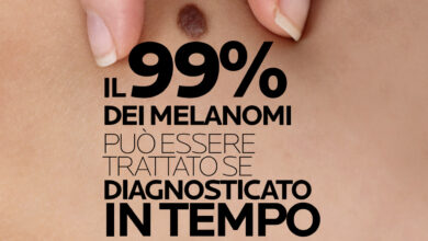 Melanoma