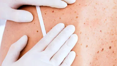 Dermatologia